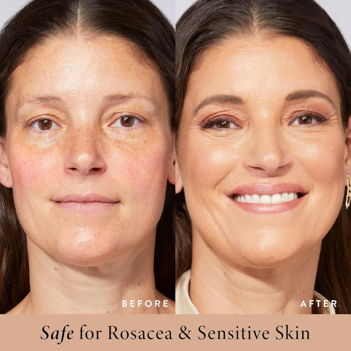 🥳2026 HOT SALE💞50K+ SOLD!🎁BB blur tinted moisturizer SPF 30 - instantly brightens, hydrates & smooths your skin